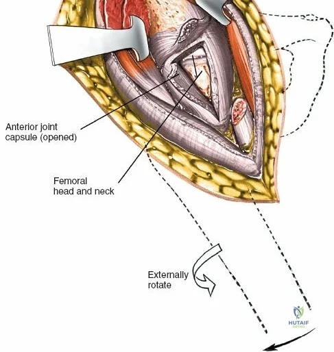 Clinical Image