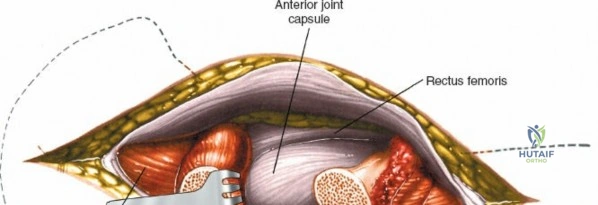 Clinical Image