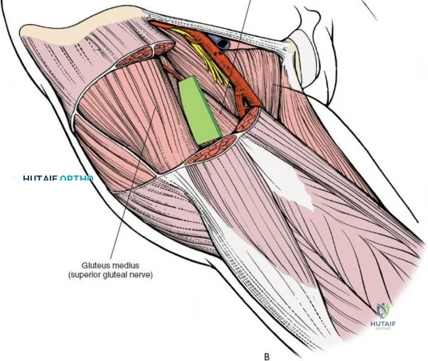 Clinical Image