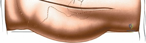 Clinical Image