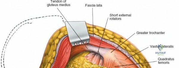 Clinical Image