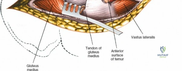Clinical Image