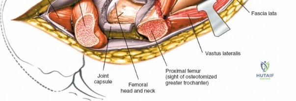 Clinical Image