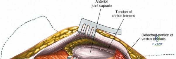 Clinical Image