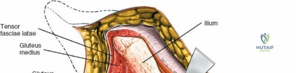 Clinical Image