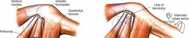 Clinical Image