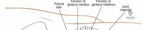 Clinical Image