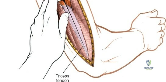 Clinical Image