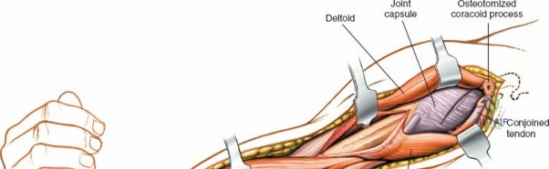 Clinical Image