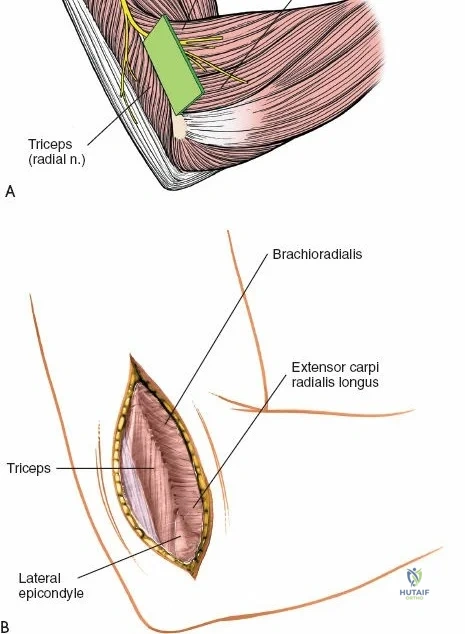 Clinical Image