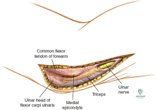 Clinical Image