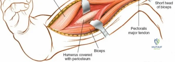Clinical Image