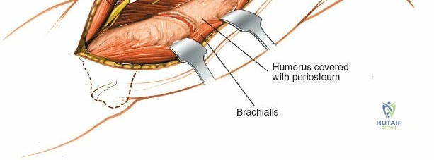 Orthopaedic oncology Generic structured oral examination question 3: Staging