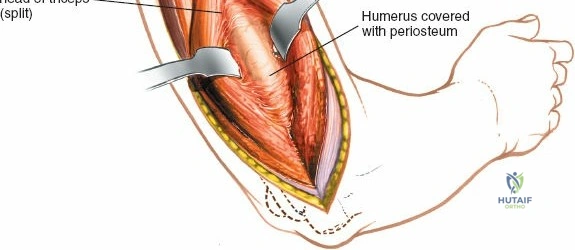 Clinical Image