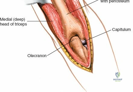 Clinical Image