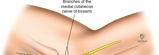 Clinical Image