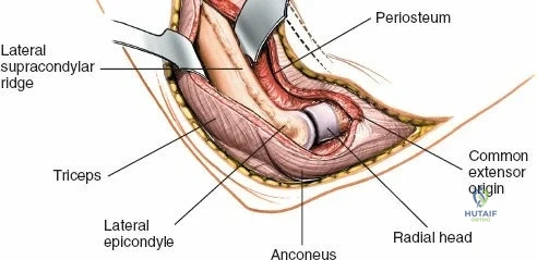 Clinical Image