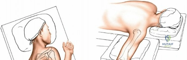 Clinical Image
