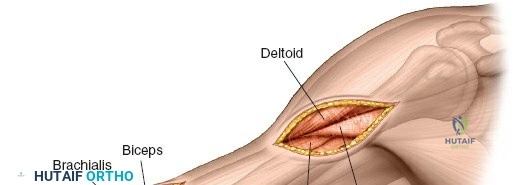 Clinical Image