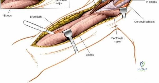 Clinical Image