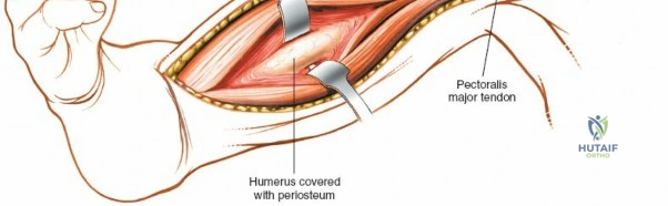 Clinical Image