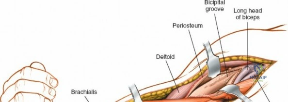Clinical Image