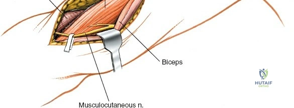 Clinical Image