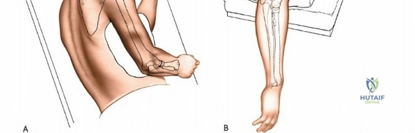 Clinical Image