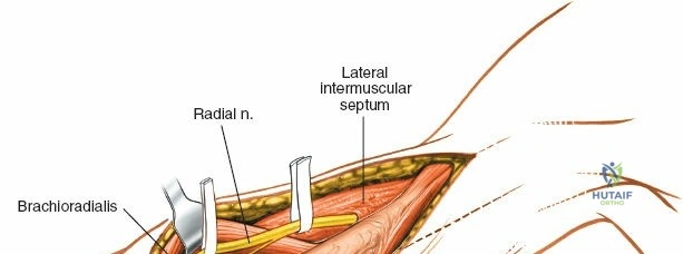 Clinical Image