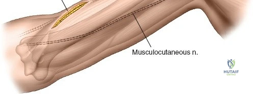 Clinical Image