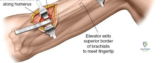 Clinical Image
