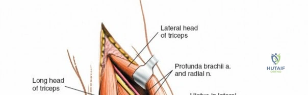 Clinical Image