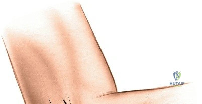 Clinical Image