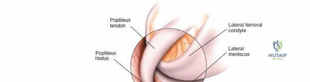 Clinical Image