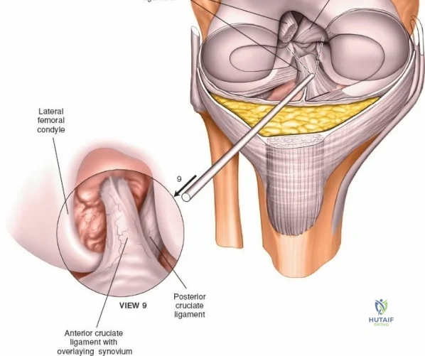 Clinical Image