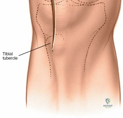 Clinical Image
