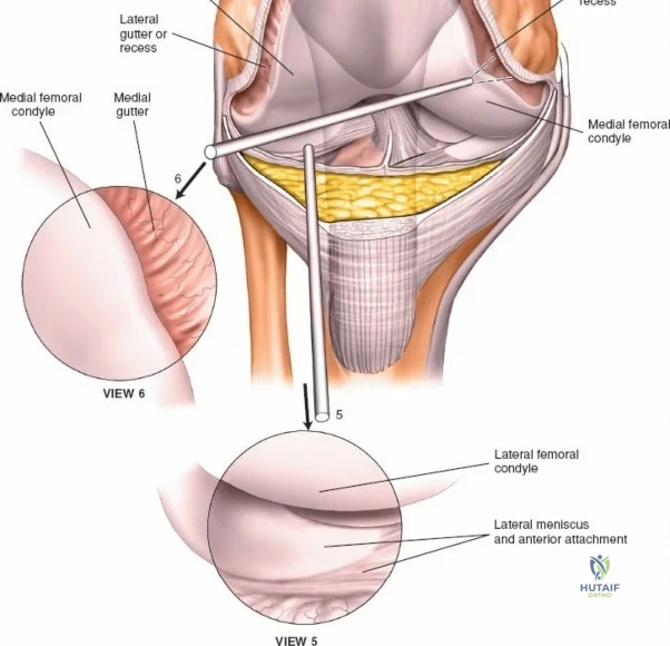 Clinical Image