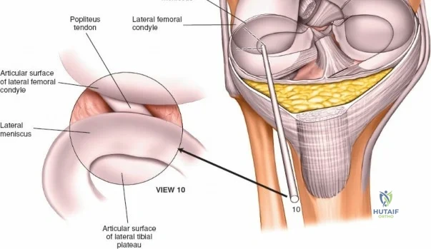 Clinical Image