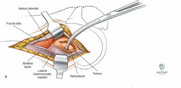 Clinical Image