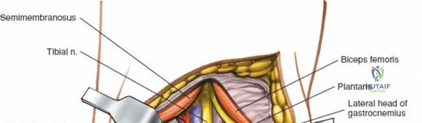 Clinical Image