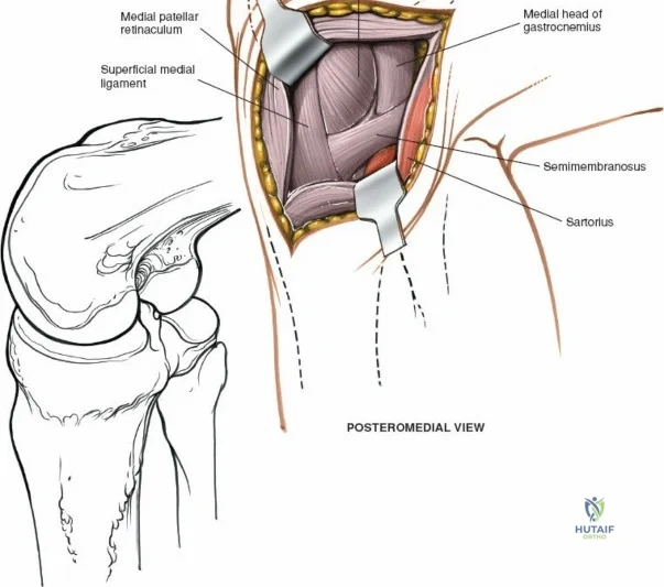 Clinical Image