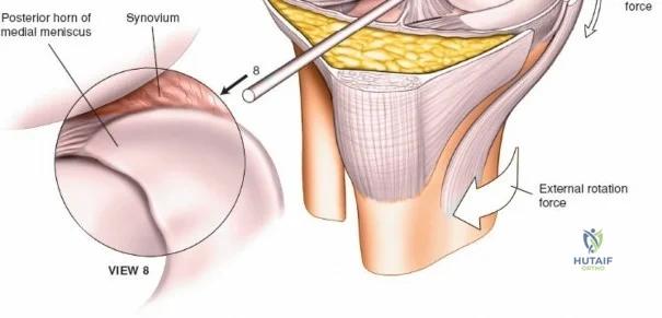 Clinical Image