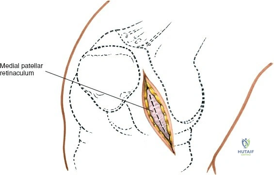 Clinical Image