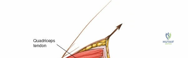 Clinical Image