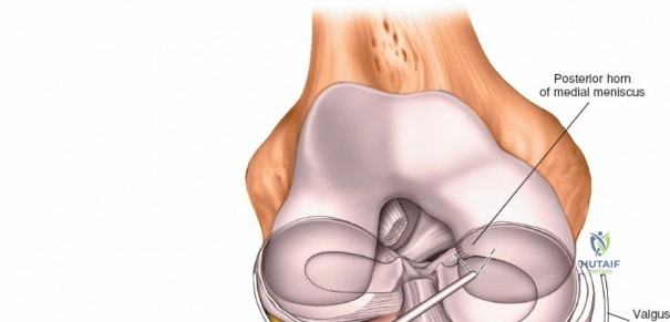 Clinical Image