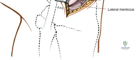 Clinical Image