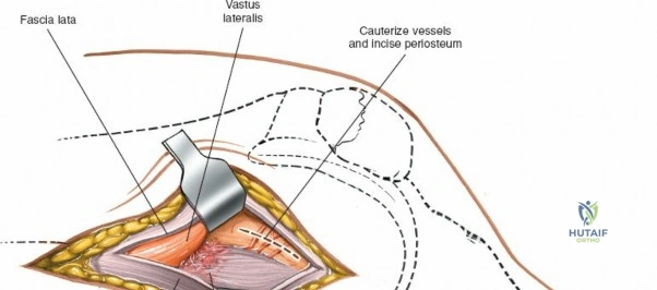 Clinical Image