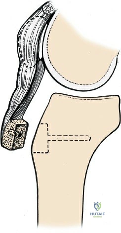 Clinical Image