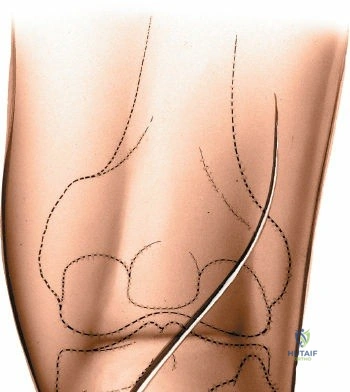 Clinical Image