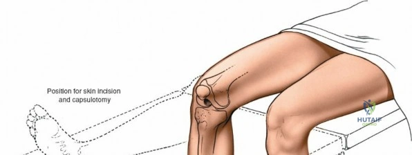 Clinical Image